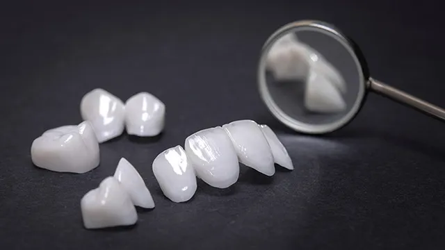 セラミックの歯が虫歯になりにくい理由の画像