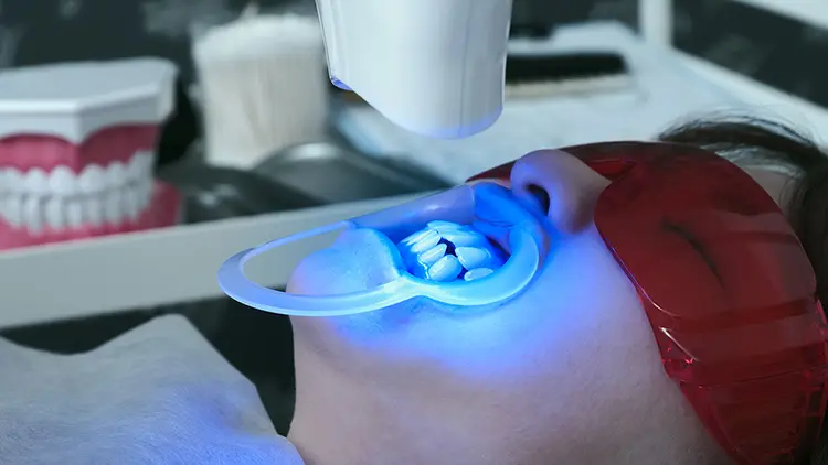 歯科医院での専門的な治療選択肢の画像