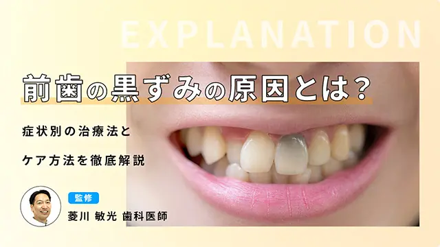 前歯の黒ずみの原因とは？症状別の治療法とケア方法を徹底解説の画像