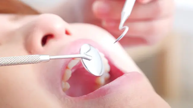 前歯の隙間を埋める4つの治療法の画像