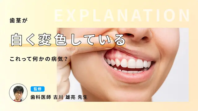 歯茎が白く変色している　これって何かの病気？ 監修：古川 雄亮歯科医師