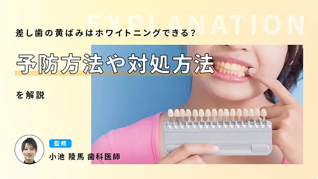 差し歯の黄ばみはホワイトニングできる？予防方法や対処方法を解説の画像