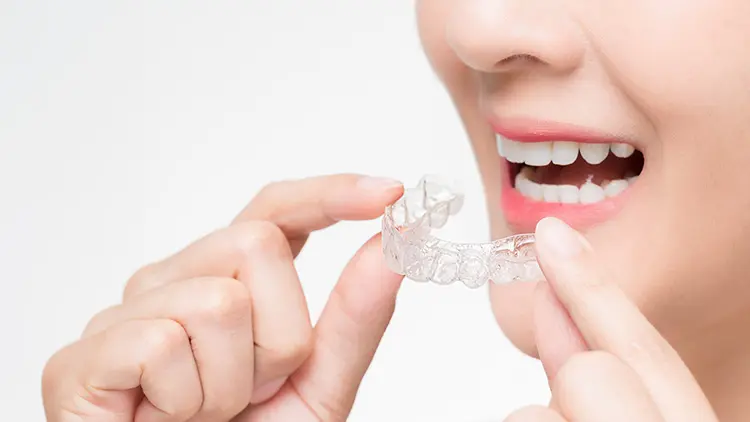 矯正中にホワイトニング治療を受ける際の注意点の画像