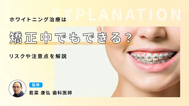 ホワイトニング治療は矯正中でもできる？リスクや注意点を解説の画像