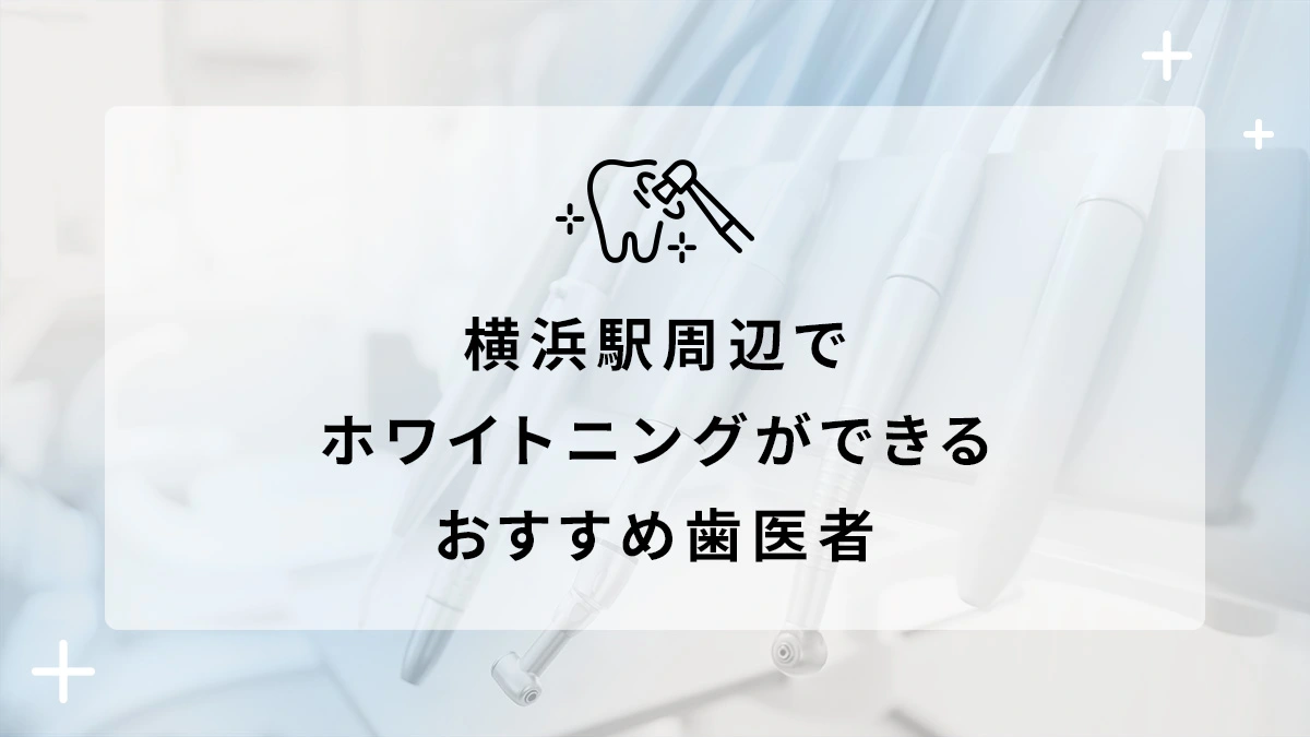 横浜駅周辺でホワイトニングができるおすすめ歯医者5選の画像