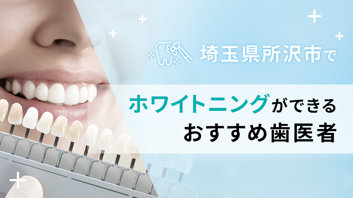 埼玉県所沢市でホワイトニングができるおすすめ歯医者5選の画像