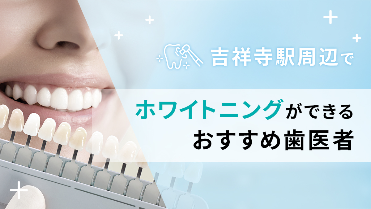 吉祥寺駅周辺でホワイトニングができるおすすめ歯医者5選の画像