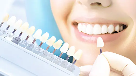 ホワイトニングができるおすすめ歯医者の画像